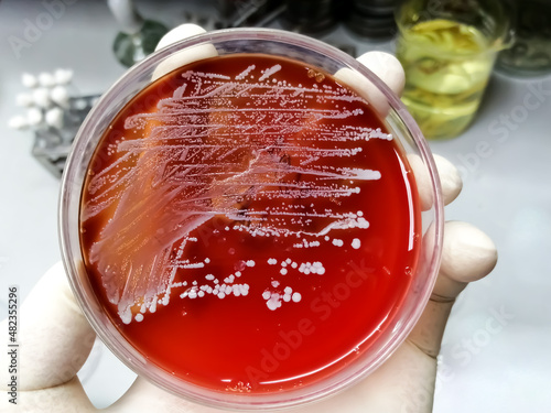 Obraz na plátně Staphylococcus aureus: Gram-positive, to Gram-variable, nonmotile, Coccus, beta hemolysis, saprotrophic bacterium that belongs to the family Staphylococcus growth on blood agar