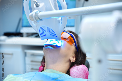 Laser bleaching teeth in clinic. photo
