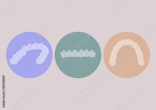A set of plastic removable dental aligners, invisible braces technology, teeth straightening, whitening, and grinding protection