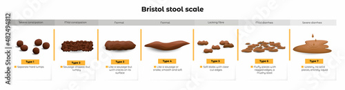 Vector isolated cartoon illustration on white of a set different types human feces, excrement in normal and diseases of diarrhea and constipation. A scale with information for correct diagnosis. photo