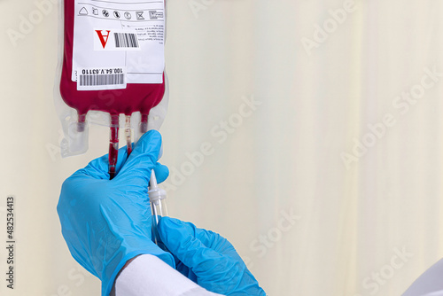 A doctor checking on a blood bag to start transfusing blood to the patient. Blood transfusion and blood donation concept.