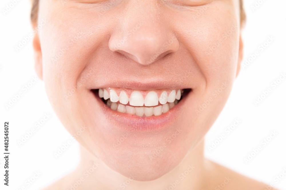 Obraz premium Wide smile with teeth close up, young woman portrait