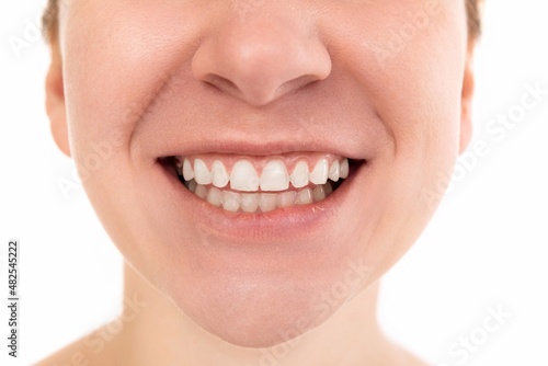 Lower half of woman face close up  smile with open mouth and white healthy teeth