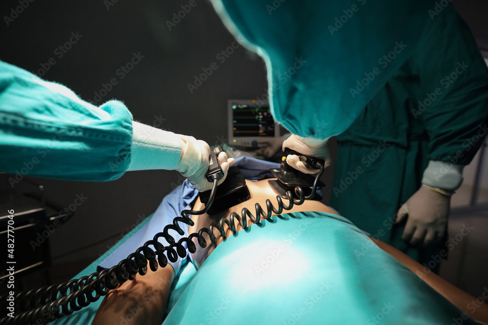 Closeup image of professional concentrated surgical team performing CPR with defibrillator on patient in hospital operating room or emergency room. Surgery concept - obrazy, fototapety, plakaty 