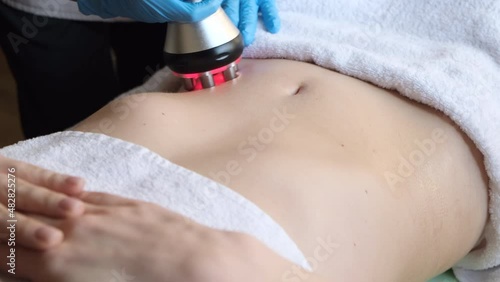 Cosmetology. A woman in a spa clinic receives an RF lifting procedure on a preparation for the abdomen and hips    photo
