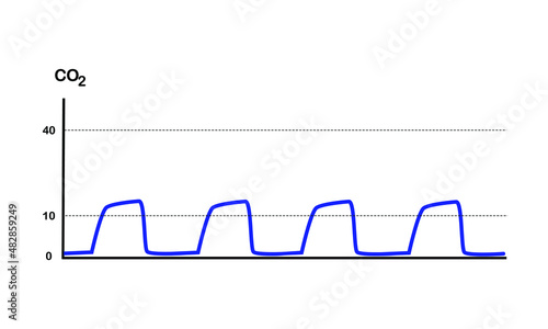 capnography waveform during high quality CPR