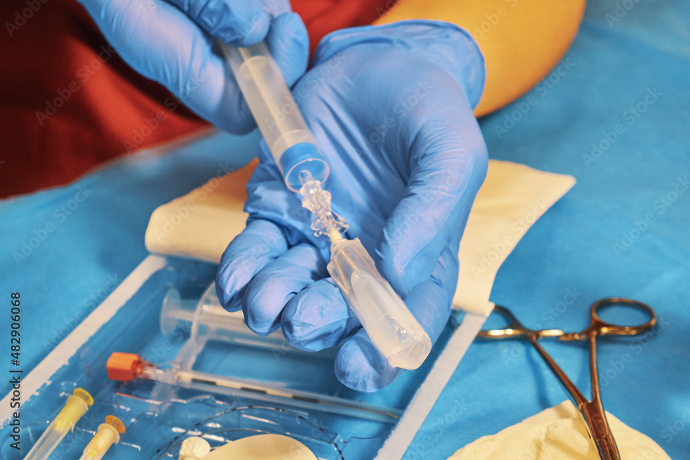 Preparation for regional anesthesia. Injection of anesthetic into a