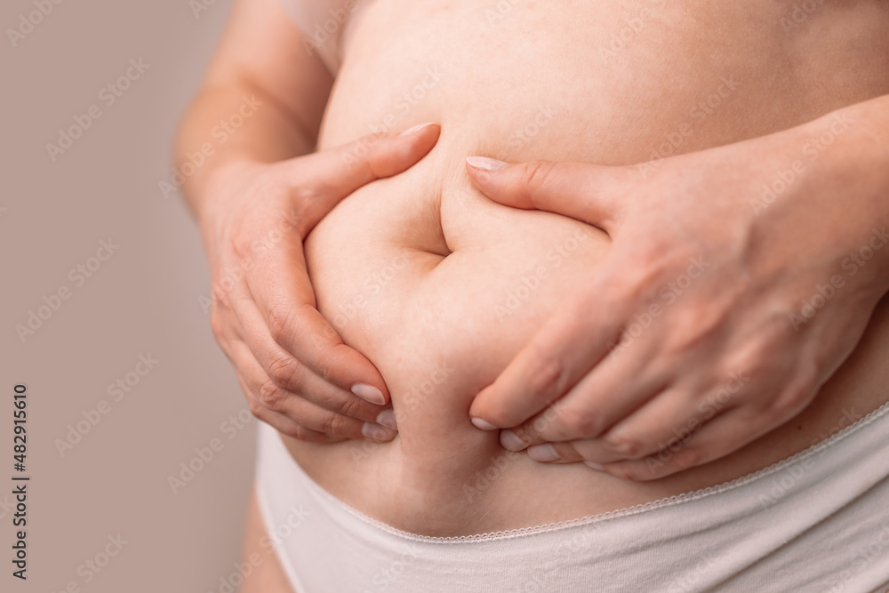Fat female belly, woman holding skin to check cellulite. Flabby skin on a fat belly, plastic surgery concept on gray background