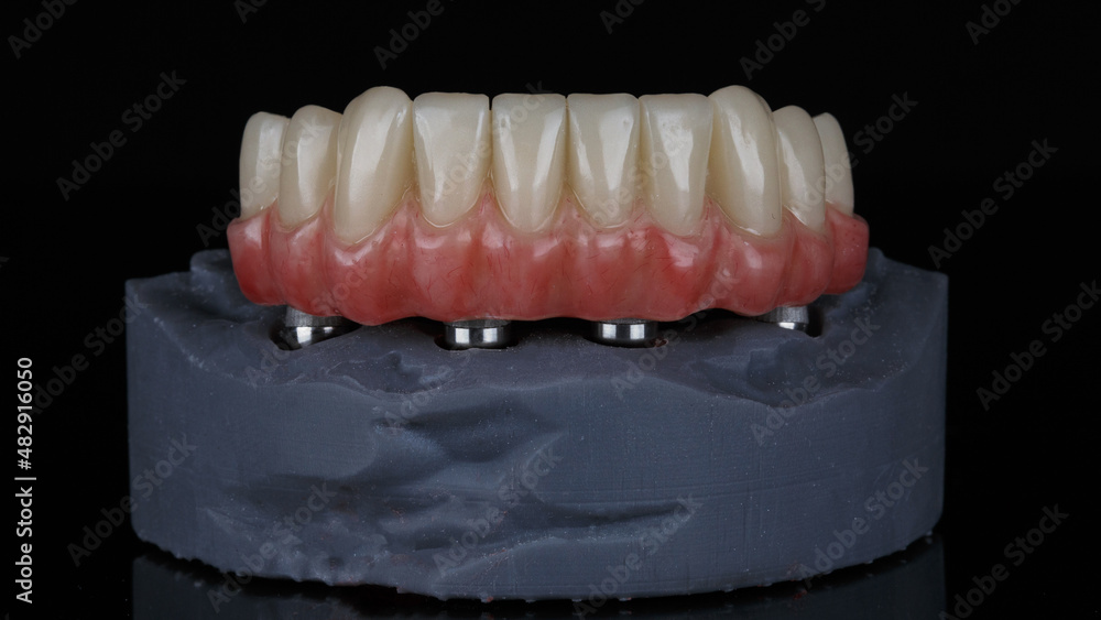 Obraz premium Beautiful dental prosthesis with pink gums and anatomy for the lower jaw on the model with beam, shot on a black background