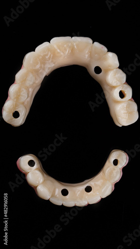 Top view of temporary dental prostheses of upper and lower jaws on a black background