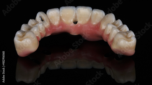 beautiful and functional morphology of the upper jaw prosthesis on black glass