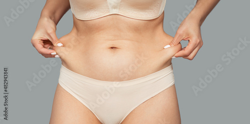 Fotografia The girl tightens the skin on her stomach, showing fat deposits in the abdomen and sides