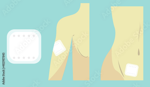 Contraceptive patch flat vector illustration