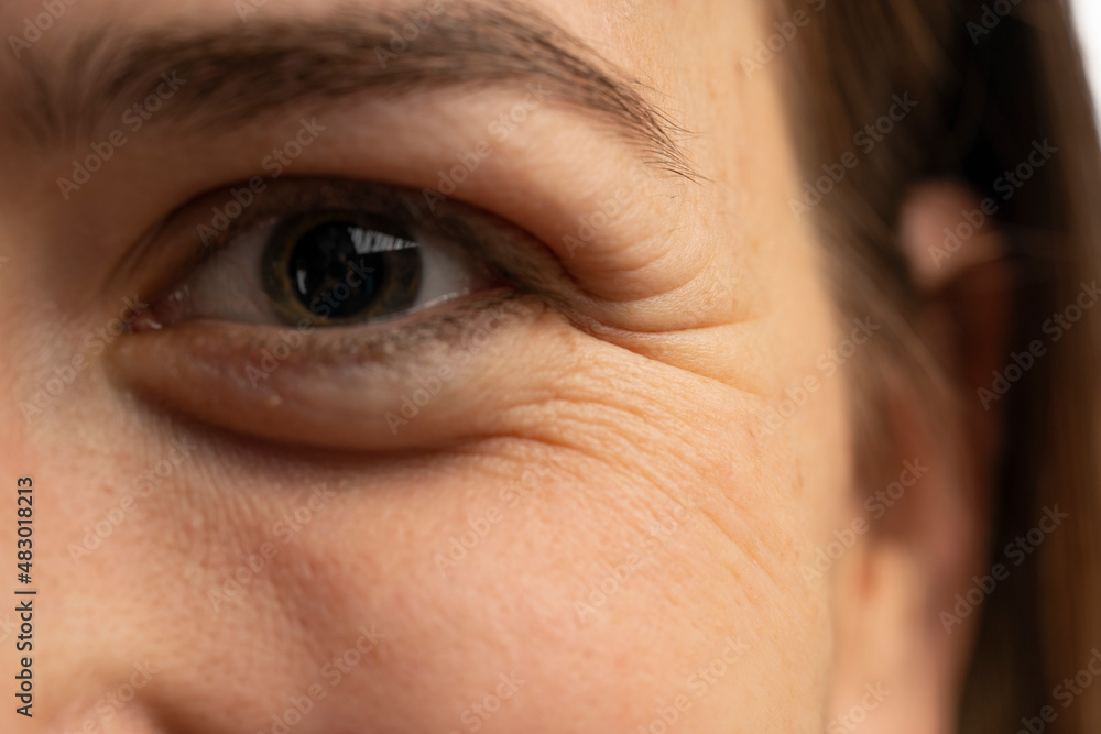 Obraz premium Young caucasian women eye wrinkles closeup