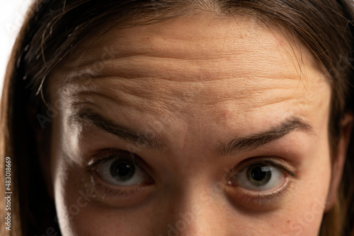 Young caucasian women forehead wrinkles closeup