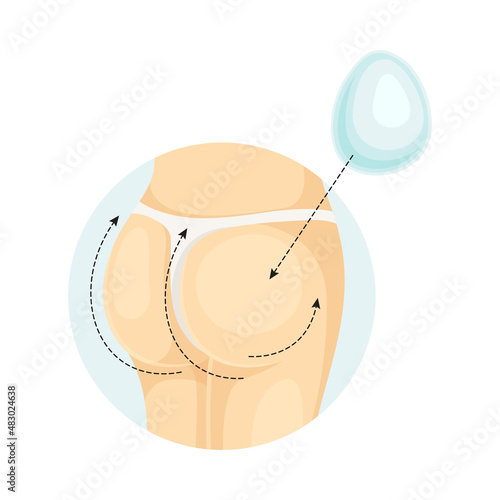 Female buttocks after correction of implants. Plastic surgery vector illustration