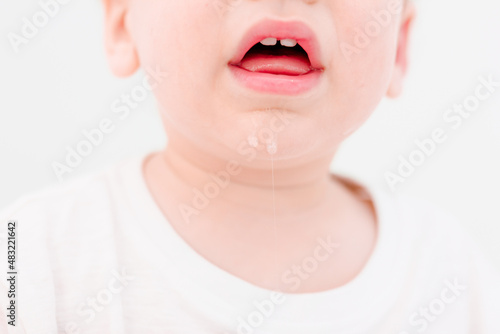 Close-up to babys mouth with two teeth. Drool is drooling from his mouth. concept of painful teething, childrens crying
