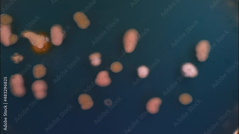 Timelapse of the growth of bacteria and microorganisms in a petri dish on agar. Timelapse of the growth of bacteria and microorganisms in a petri dish on agar.
