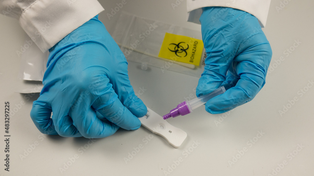 antigenic swab, covid 19 virus detector, with test tube, liquid, negative result, performed by the hands of a doctor with blue gloves. antigenic swab, covid 19 virus detector, with test tube, liquid, negative result, performed by the hands of a doctor with blue gloves.