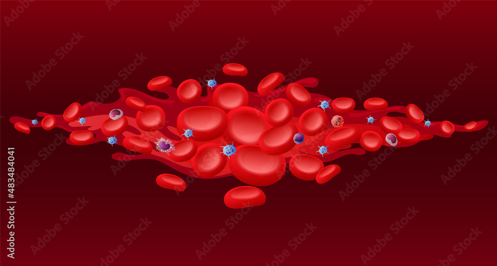 Red blood cells with viral infection bacteria 3d vector cartoon illustration. Microbe virus and erythrocytes