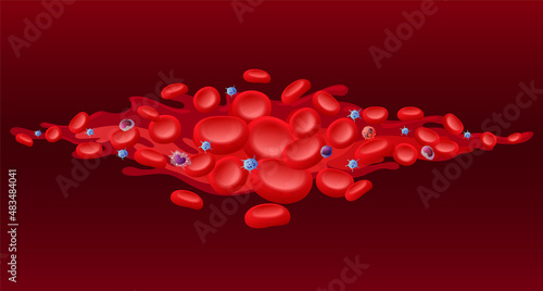Red blood cells with viral infection bacteria 3d vector cartoon illustration. Microbe virus and erythrocytes