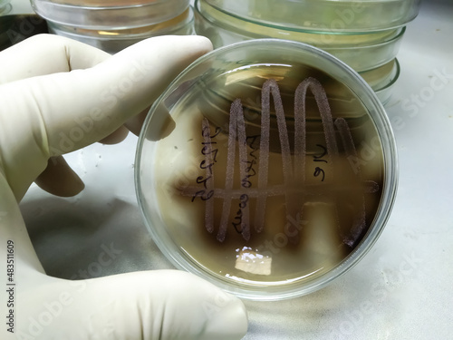 A petri dish with bile esculin agar (BEA) showing bacterial colonies of Enterococcus spp. bacterial black colonies photo