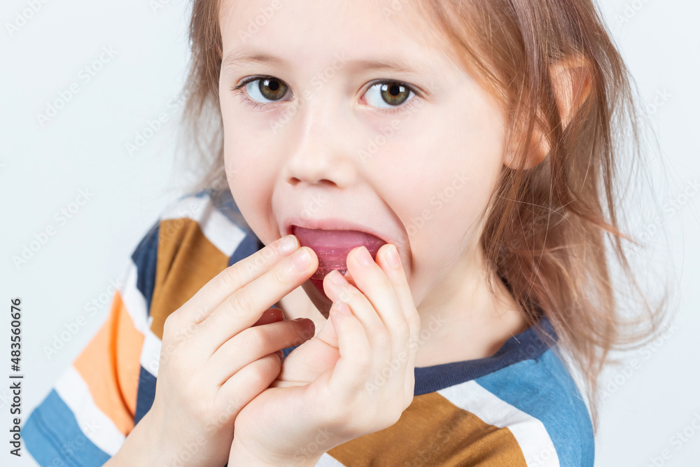 Adorable little girl puts myofunctional trainer in the mouth. Adorable little girl puts myofunctional trainer in the mouth.
