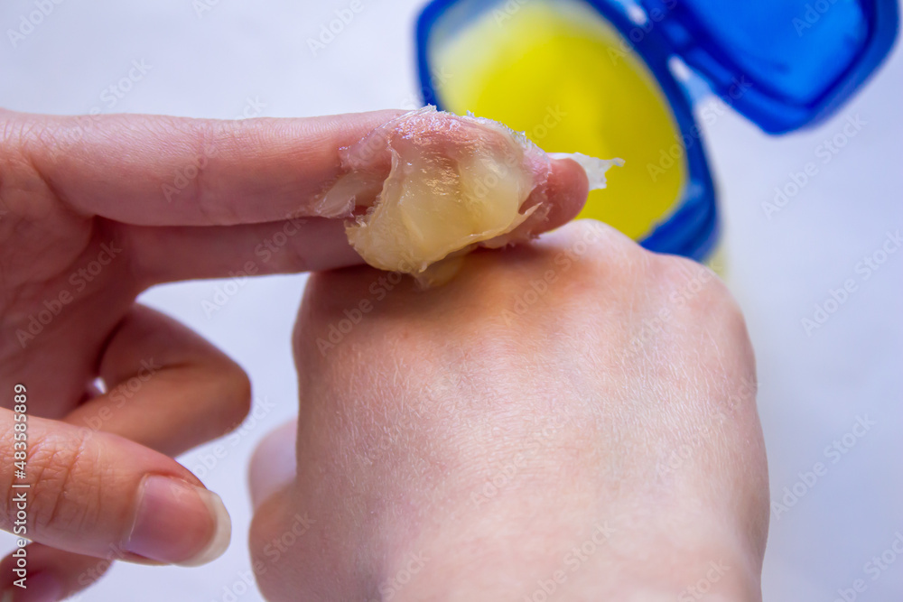 Woman using petroleum jelly for skincare. Woman using petroleum jelly for skincare.