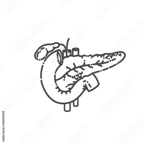 Anatomy drawing showing the pancreas, duodenum, and gallbladder