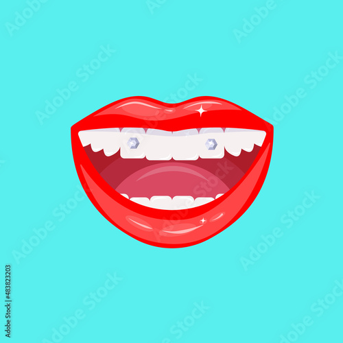 Teeth piercing with diamonds. Female mouth with snow-white teeth. Smile piercing. Decoration of teeth with jewelry stones, gem. Aesthetic dentistry. Vector illustration