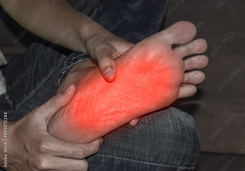 Tingling and burning sensation in foot of Asian. Foot pain. Sensory