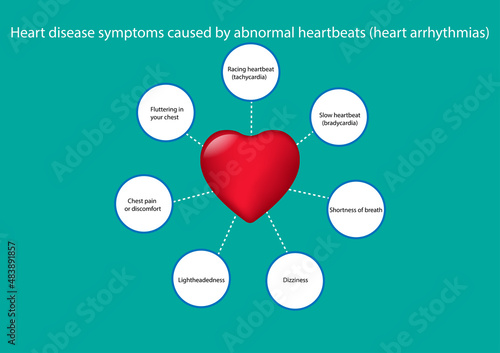 GRAPHICS DRAWING CONCEPT Heart disease symptoms caused by abnormal heartbeats, vector illustration