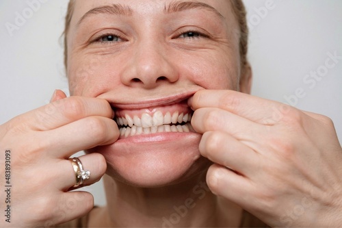 girl stretches her mouth with her hands in a smile