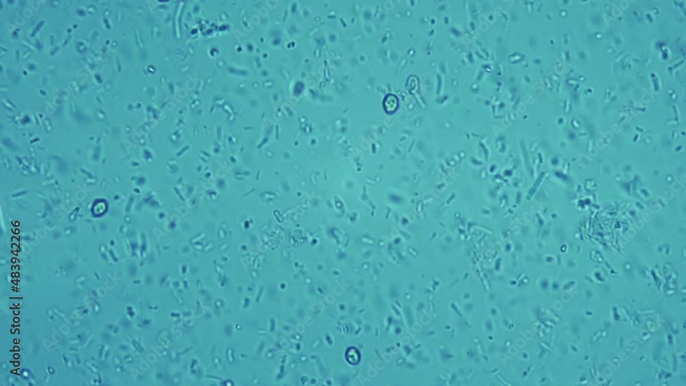 Tetanus stick. The causative agent of rabies in humans and animals. Saliva of a wild mammal under a microscope. Human diseases. Lockjaw is transmitted from wild animals to humans Tetanus stick. The causative agent of rabies in humans and animals. Saliva of a wild mammal under a microscope. Human diseases. Lockjaw is transmitted from wild animals to humans