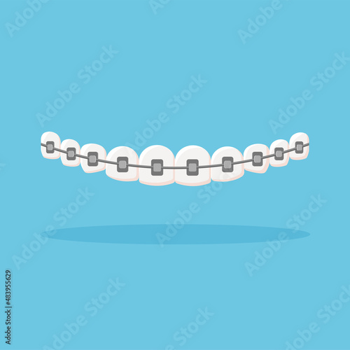 Row of teeth with braces. Orthodontic dentistry concept. Alignment of teeth. Dental care. Vector illustration isolated on blue background.