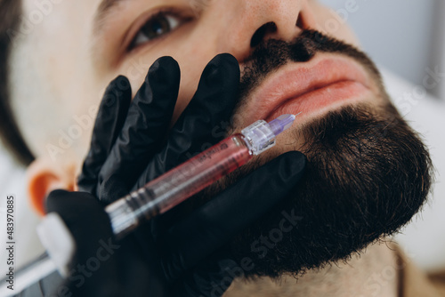 Stylish bearded man visiting aesthetic clinic, getting lips filler, closeup. Attractive Man having beauty injection at male spa salon. Anti-aging treatment for men concept.