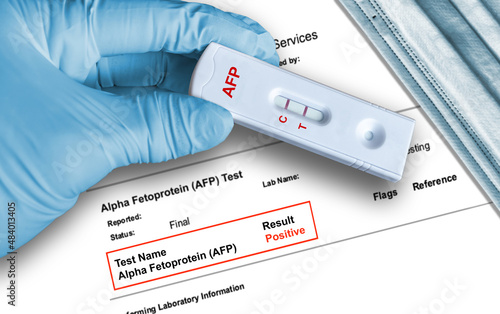 Positive AFP test result by using rapid self testing cassette for Alpha Fetoprotein photo