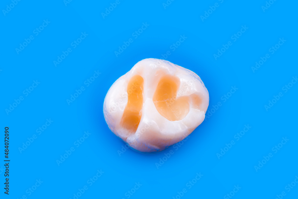 tooth etching before starting composite restiration tooth etching before starting composite restiration