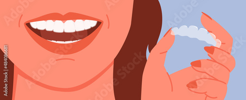 Cartoon woman holding invisalign transparent braces with smile, orthodontic denture banner template background. Invisible dental braces correction for tooth, dentistry health care vector illustration