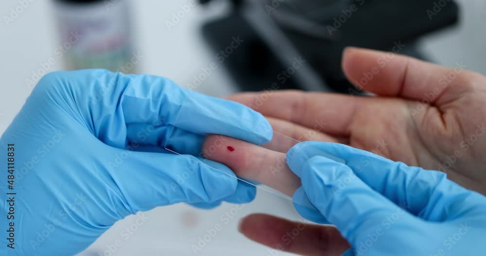 Doctor taking blood sample for testing hemoglobin level closeup Doctor taking blood sample for testing hemoglobin level closeup