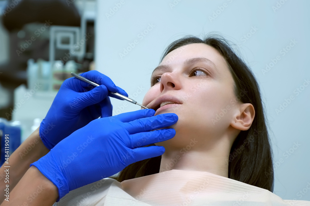 Dental examination at the dentist for young caucasian woman in dentistry. Dentistry business concept. Patient sitting in stomatology chair with open mouth, doctor is checking her teeth using mirror. Dental examination at the dentist for young caucasian woman in dentistry. Dentistry business concept. Patient sitting in stomatology chair with open mouth, doctor is checking her teeth using mirror.