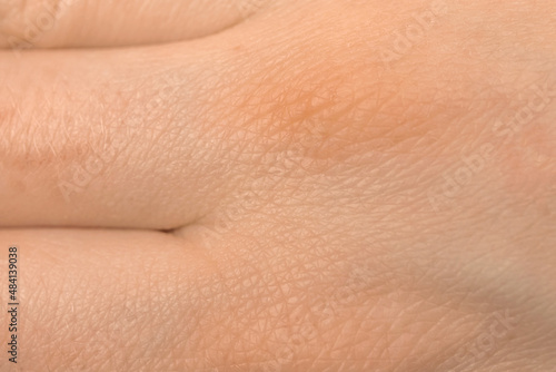 Human hand skin texture. Detail healthy pink skin background photo