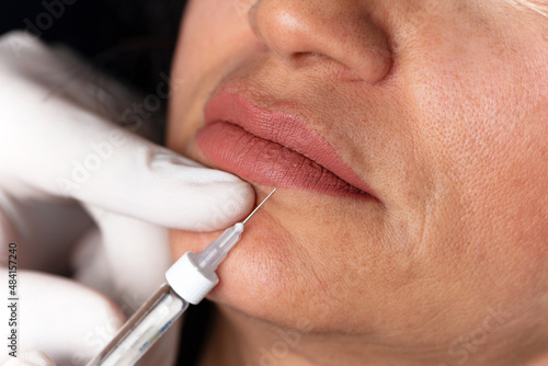 lady getting botox injection for bigger, fuller lips. The woman in the beauty salon. Plastic surgery clinic.