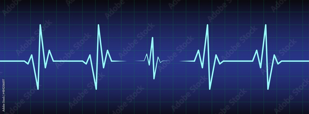Ecg, ekg monitor with cardio diagnosis. Heart rhythm line vector design to use in healthcare, healthy lifestyle, medicine and ekg, ecg concept illustration projects. 