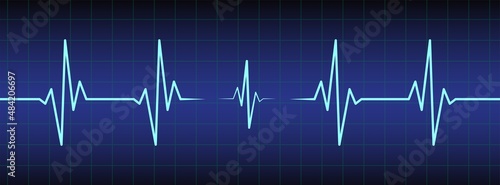Ecg, ekg monitor with cardio diagnosis. Heart rhythm line vector design to use in healthcare, healthy lifestyle, medicine and ekg, ecg concept illustration projects. 
