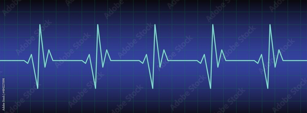 Ecg, ekg monitor with cardio diagnosis. Heart rhythm line vector design to use in healthcare, healthy lifestyle, medicine, ekg, ecg concept illustration projects. 