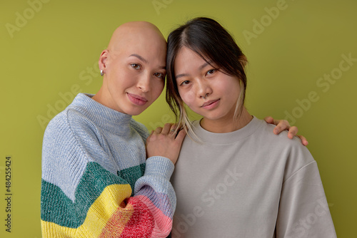 Fotografie Diverse women posing at camera supporting each other, asian and another caucasian bald models, looking at camera smiling