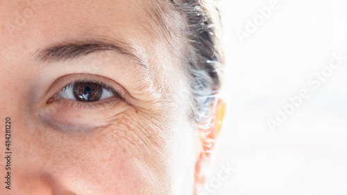 Close up on facial wrinkles. Expression wrinkle treatment. Dry and not very elastic skin. Skin aging concept. Prevention of the signs of aging on the face.