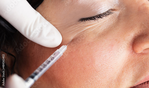 Plastic surgery clinic. Hands of cosmetologist making botox injection holding Syringe. Concept of healthy face, skin care, middle age skin care cosmetics, aesthetics.
