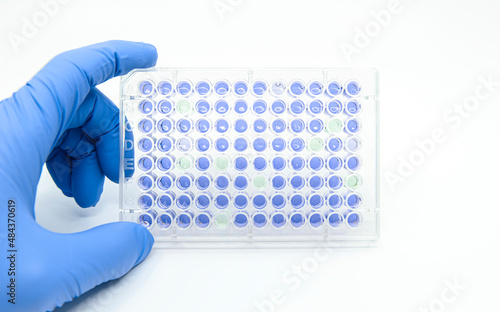 Scientist is holding 96 well micro plate that  tested enzyme linked immunosorbent assay(ELISA) for drug screening in laboratory